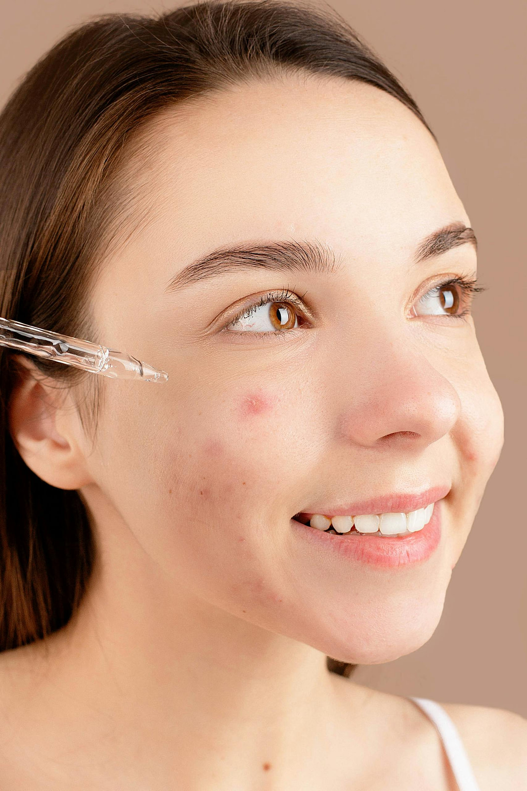Red Light Therapy Benefits - #10
Helps with Acne Reduction