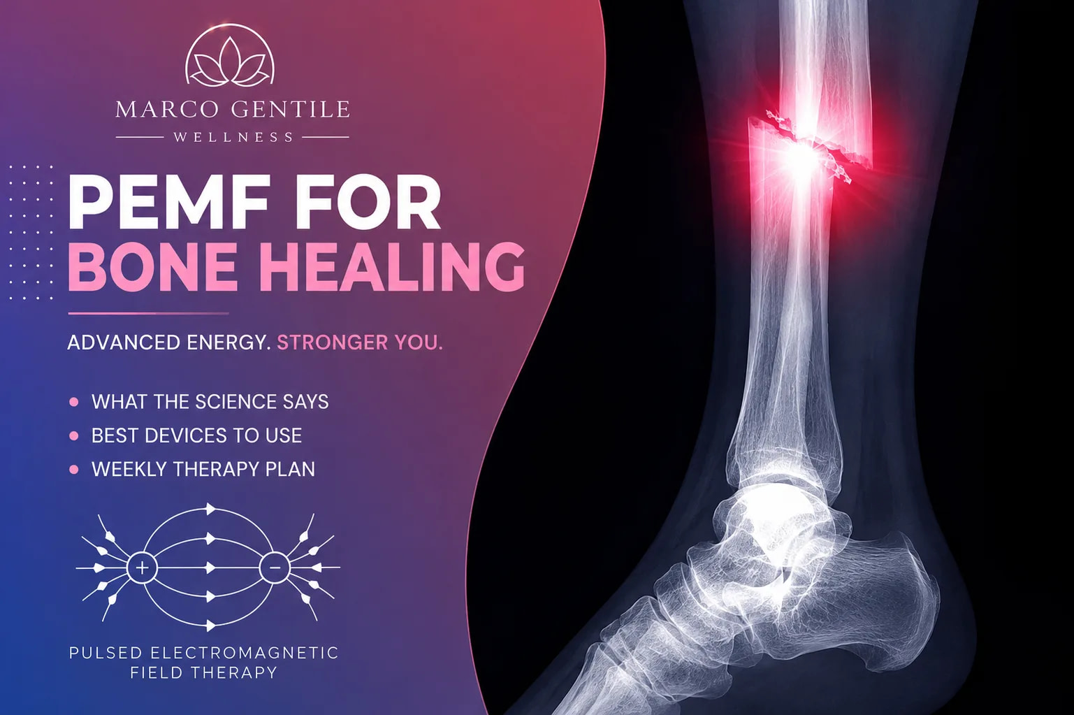 PEMF for Bone Healing
