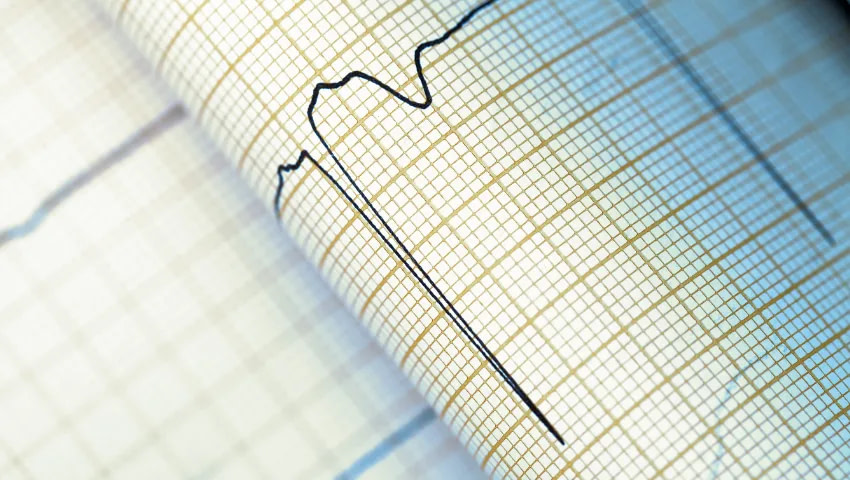 PEMF Mat Benefits - Arrhythmia