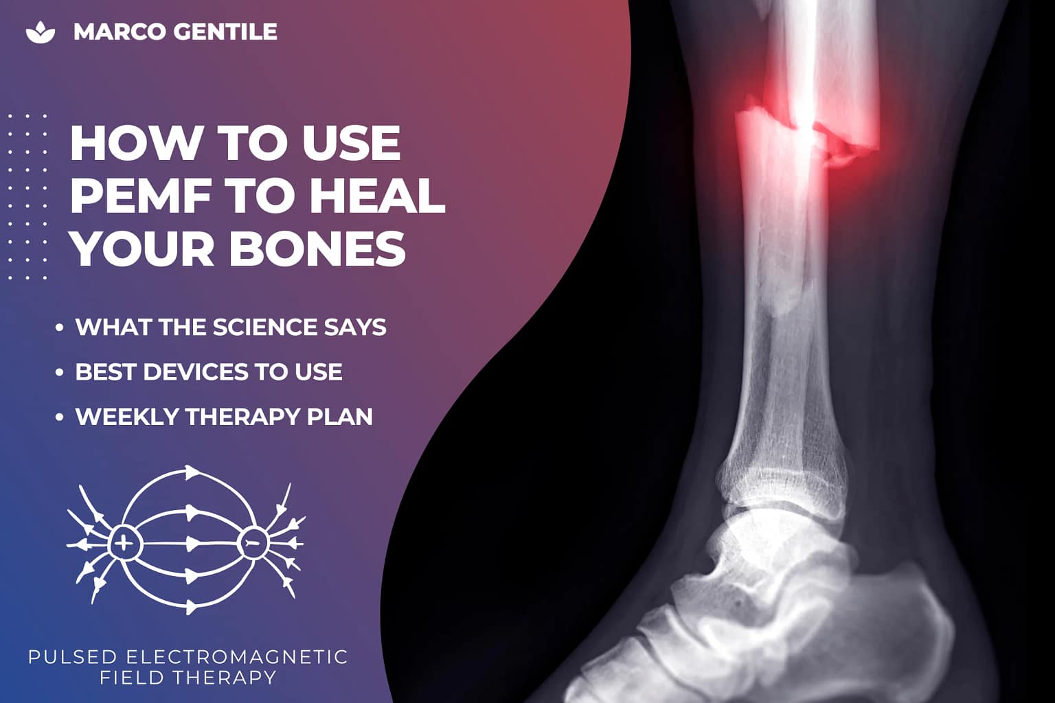 pemf for bone healing