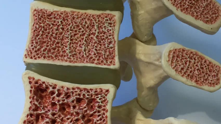 Benefici Materassino Magnetoterapia - Osteoporosi